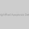 TUNEL BrightRed Apoptosis Detection Kit